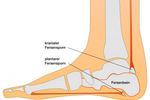 Fersenbein