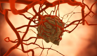 Chemotherapie